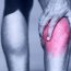 Como saber músculo está lesionado? – Saúde Press